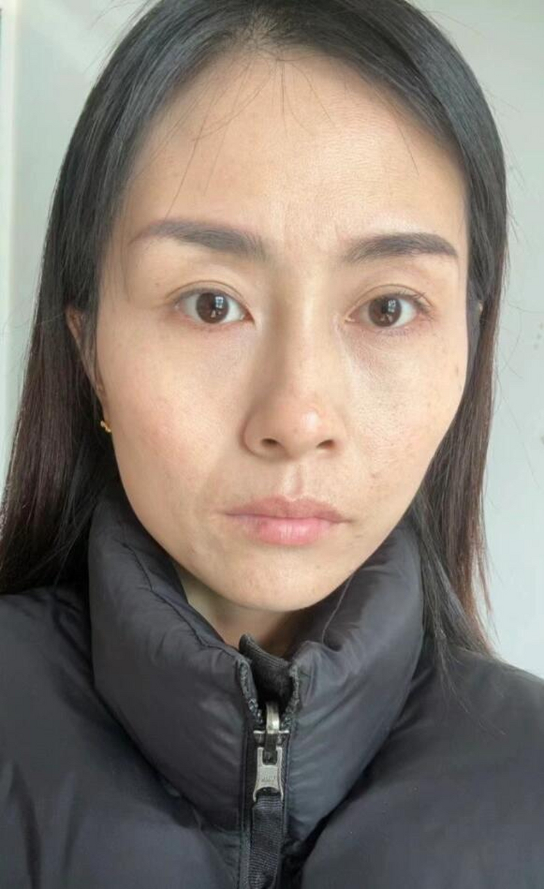 被老公吐槽像男人婆,没有女人味,所以去微调了.