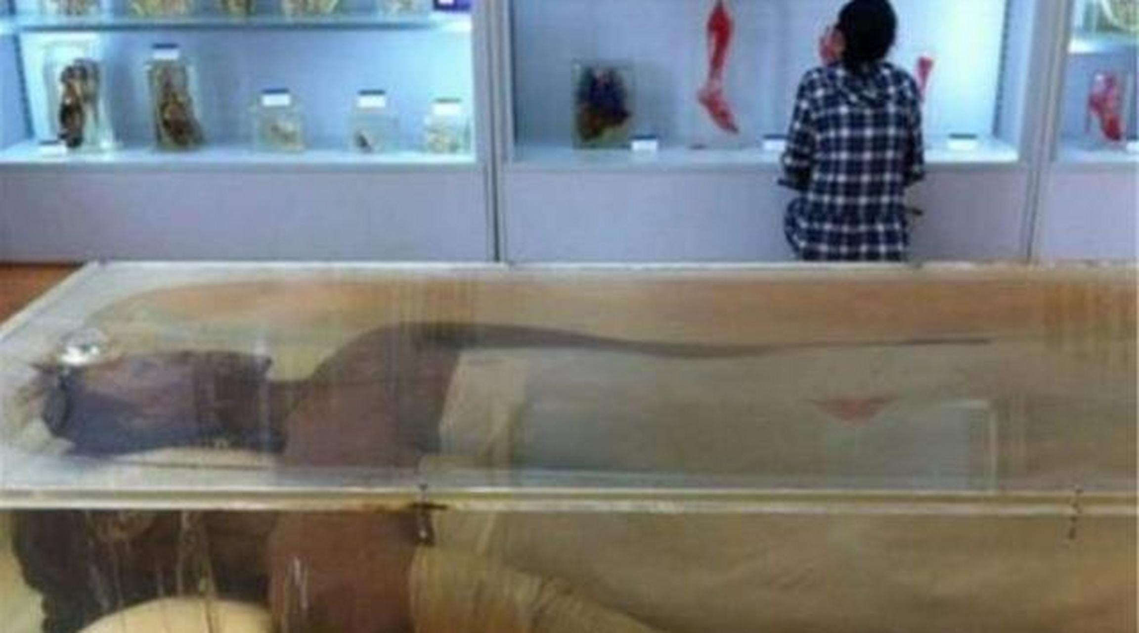 2005年,湖南湘雅医学院,中国"第一女巨人"曾金莲的遗体被安放在标本室