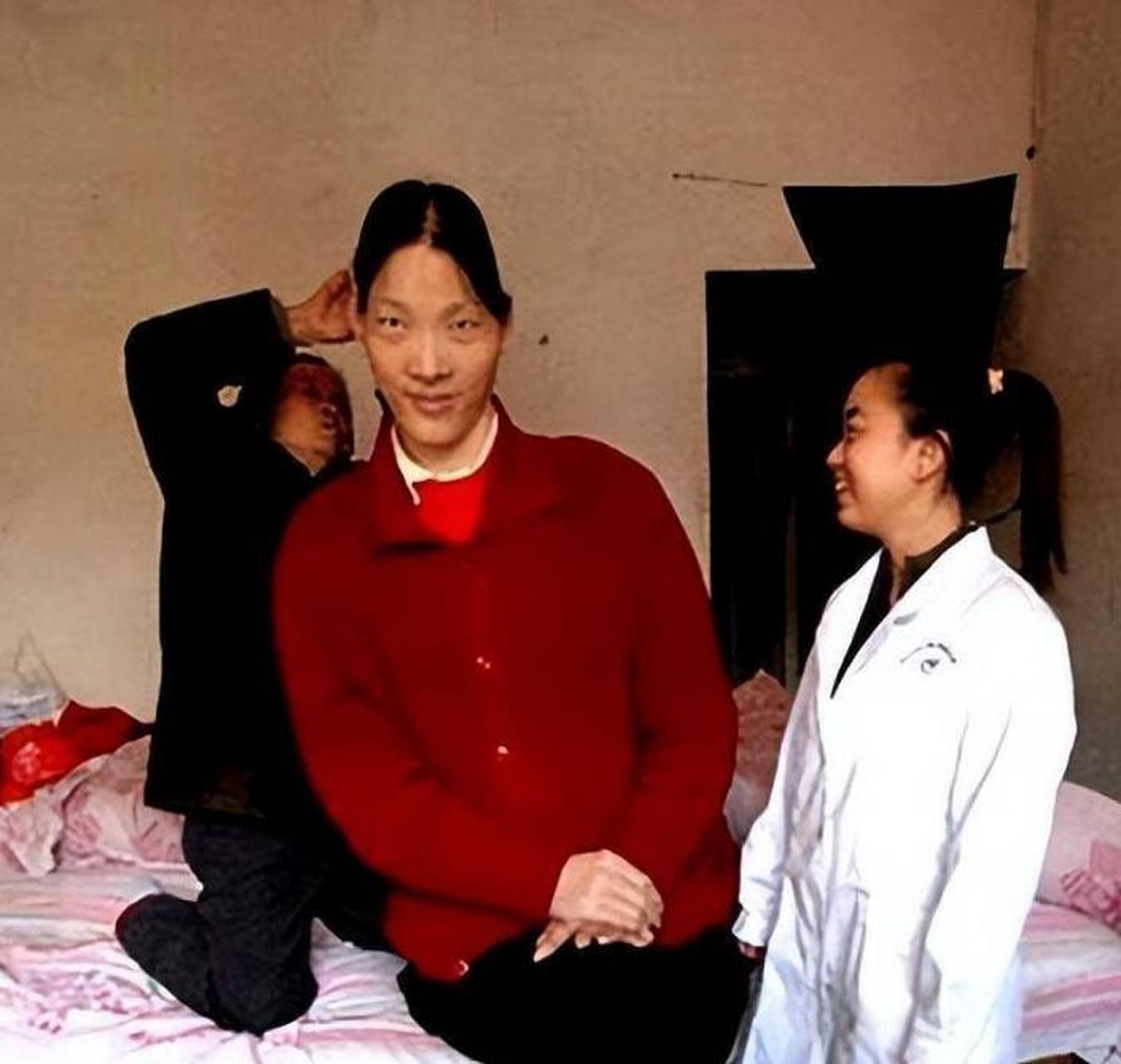 2005年,湖南湘雅医学院,中国"第一女巨人"曾金莲的遗体被安放在标本室