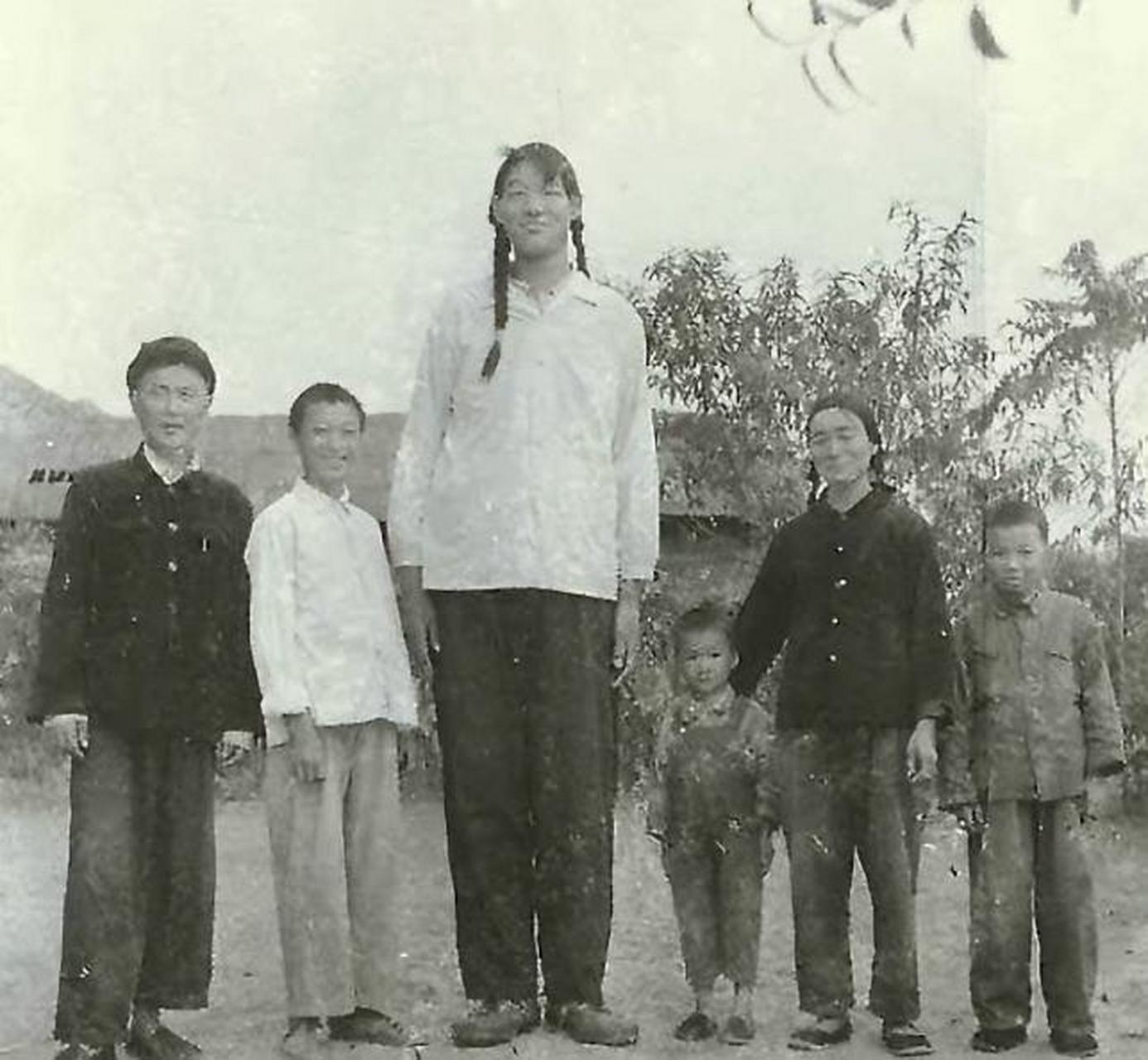 2005年,湖南湘雅医学院,中国"第一女巨人"曾金莲的遗体被安放在标本室
