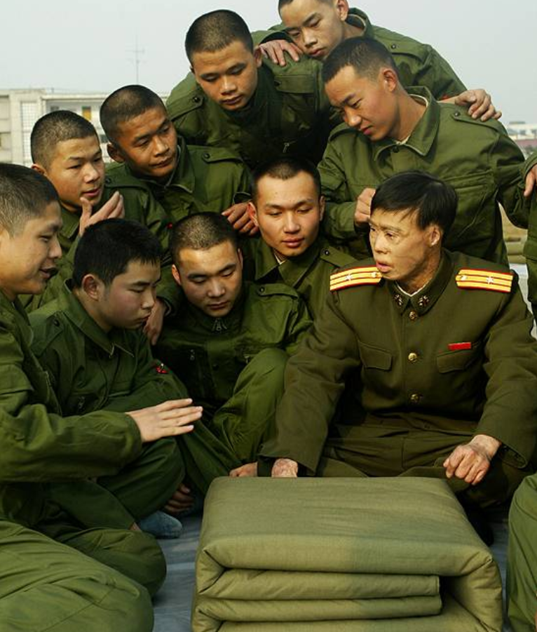 1995年,兵哥哥梁强救一车乘客被重度烧伤,初恋女友:永远不离弃