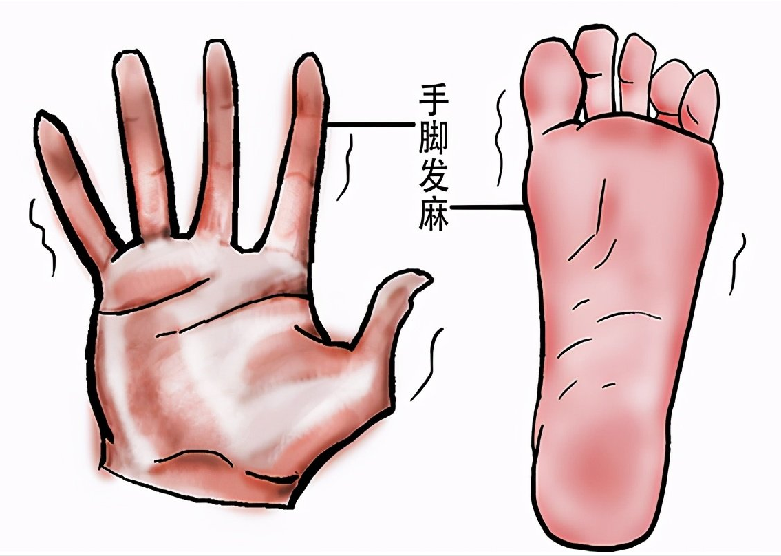 手脚抽筋麻木?别再吃钙片了!多是血虚了!