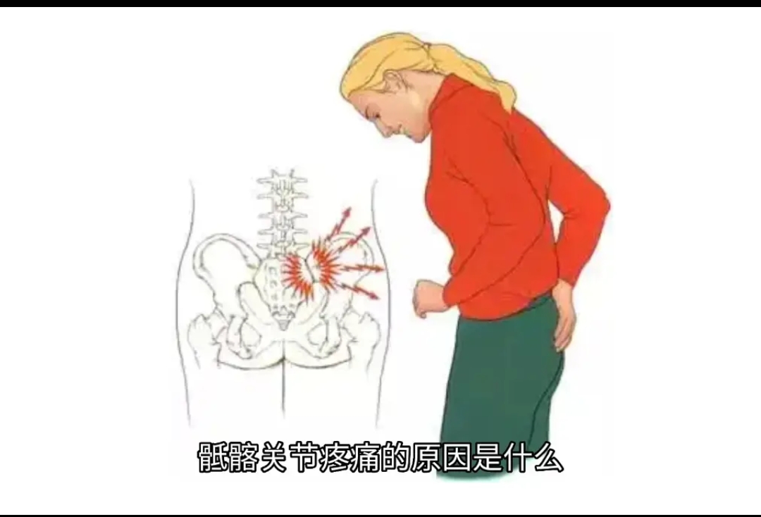 骶骨疼是怎么回事女性图片