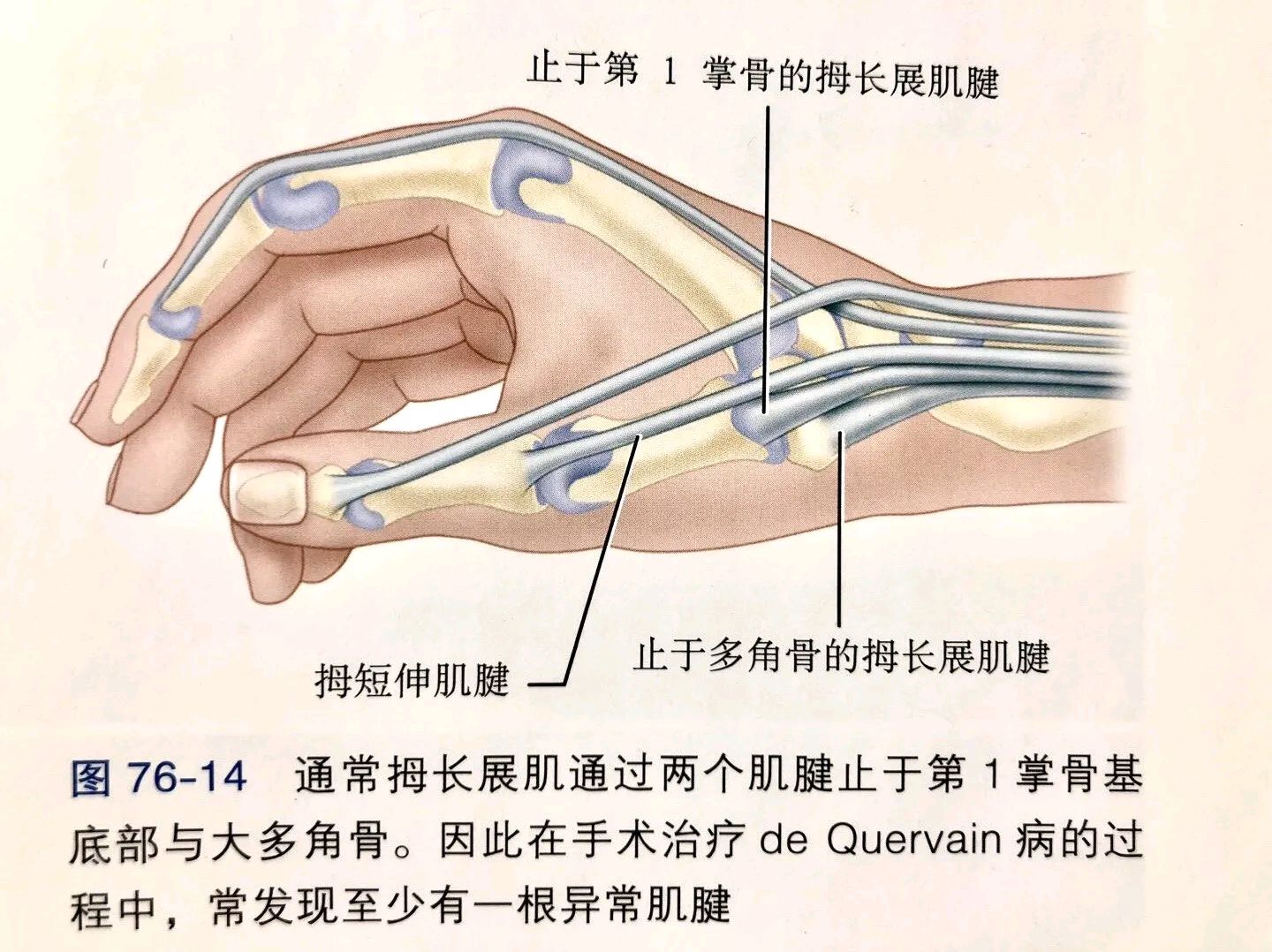 桡骨茎突腱鞘炎解剖图片