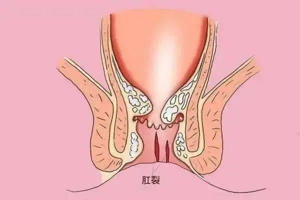 女人为什么是女科（为什么不叫女科叫妇科）《妇科为啥不叫女科》