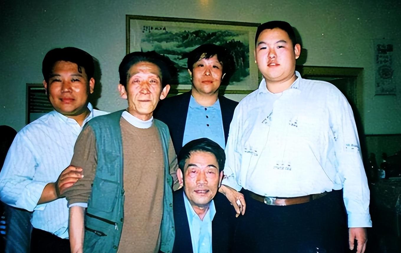 纪实:2023年相声演员杨少华突发疾病住院,如今却喝酒吃肉抽华子
