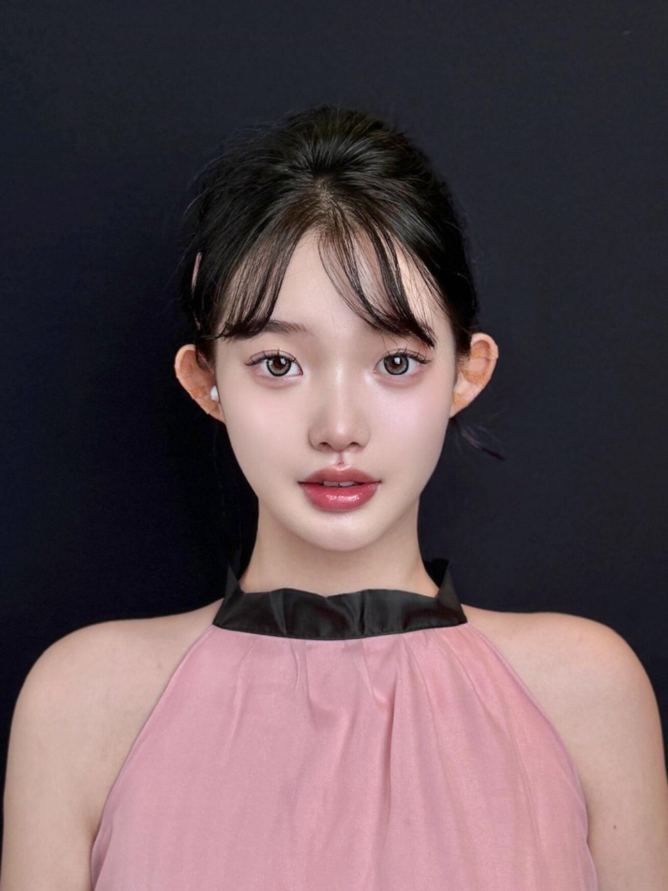 40岁,do了个幼态脸,一眼假吗?