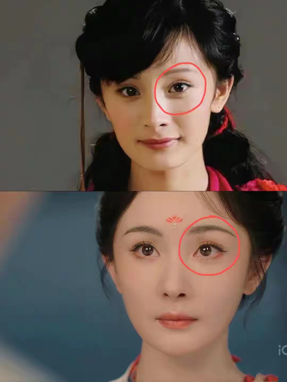 而且从之前的平行变成了扇形双眼皮,都说人老人眼先老,女明星也是扛不