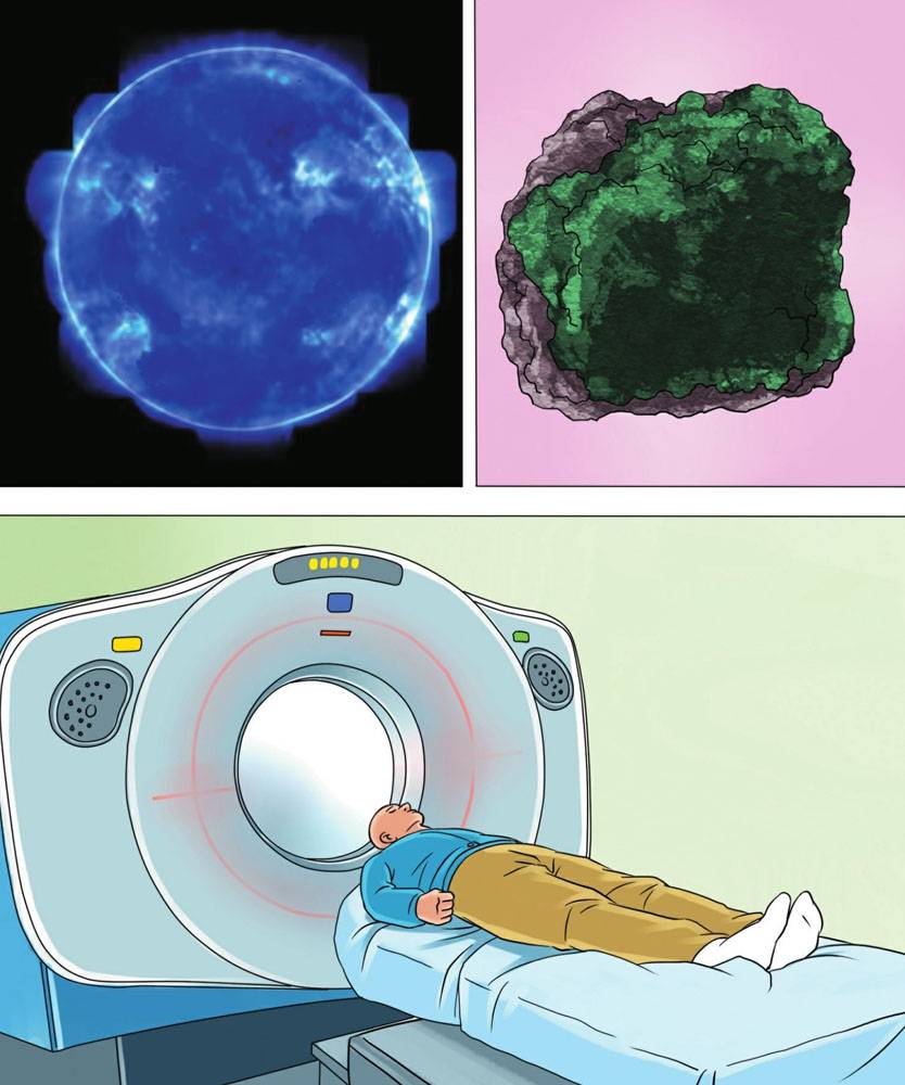 天然辐射和人工辐射,都有哪些?
