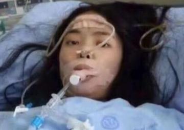 白血病的最终死亡状态图片