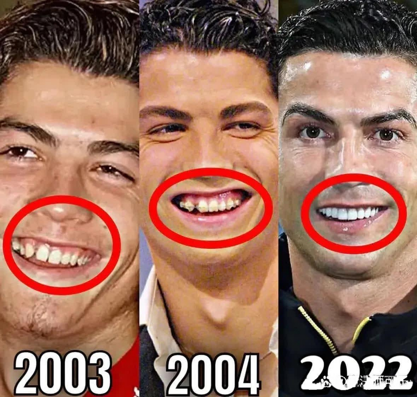 c罗的笑容越来越亮,牙齿也越来齐白,明星的烤瓷牙肯定不便宜