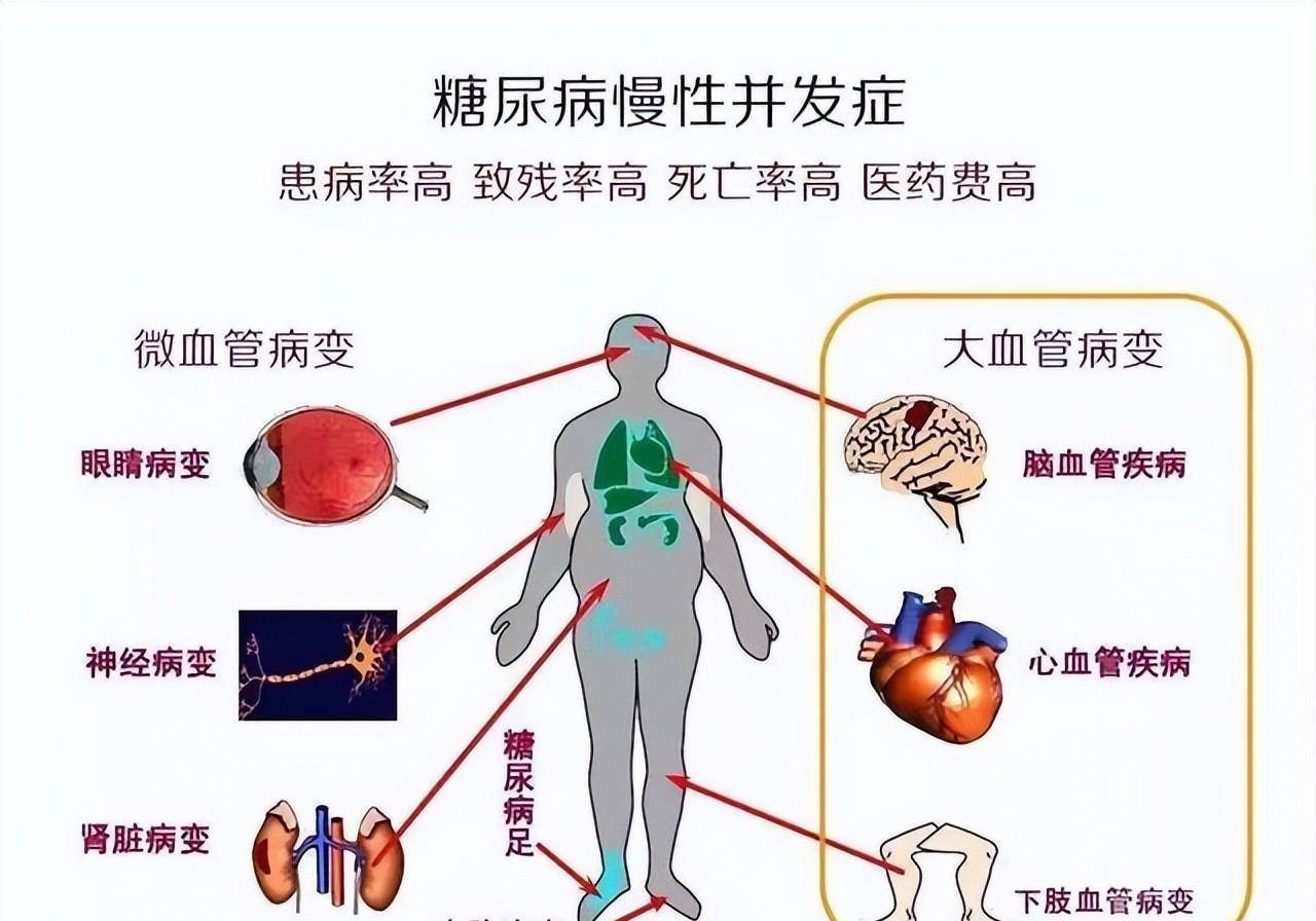 只有餐后血糖高