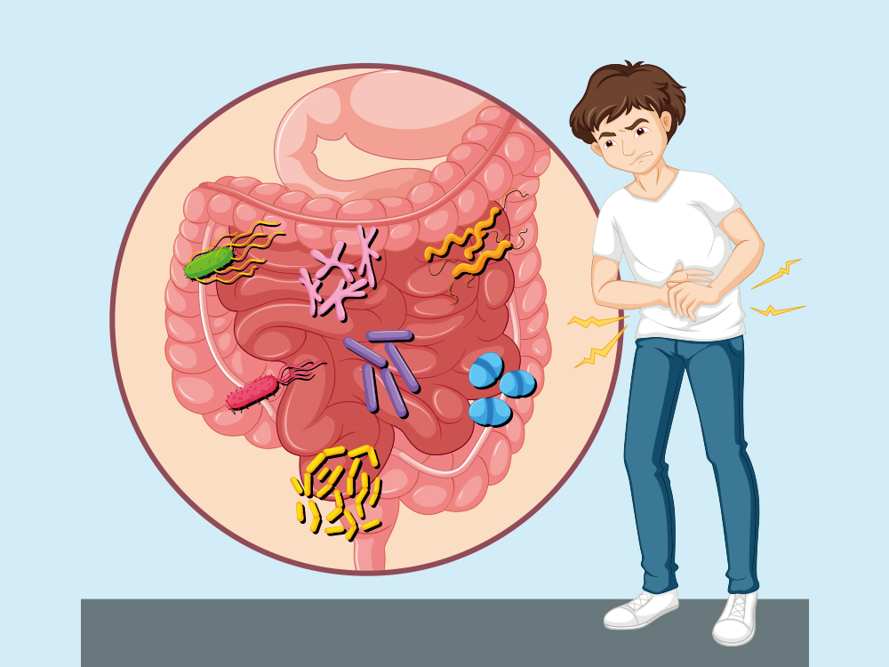 肠道菌群失调的5种迹象