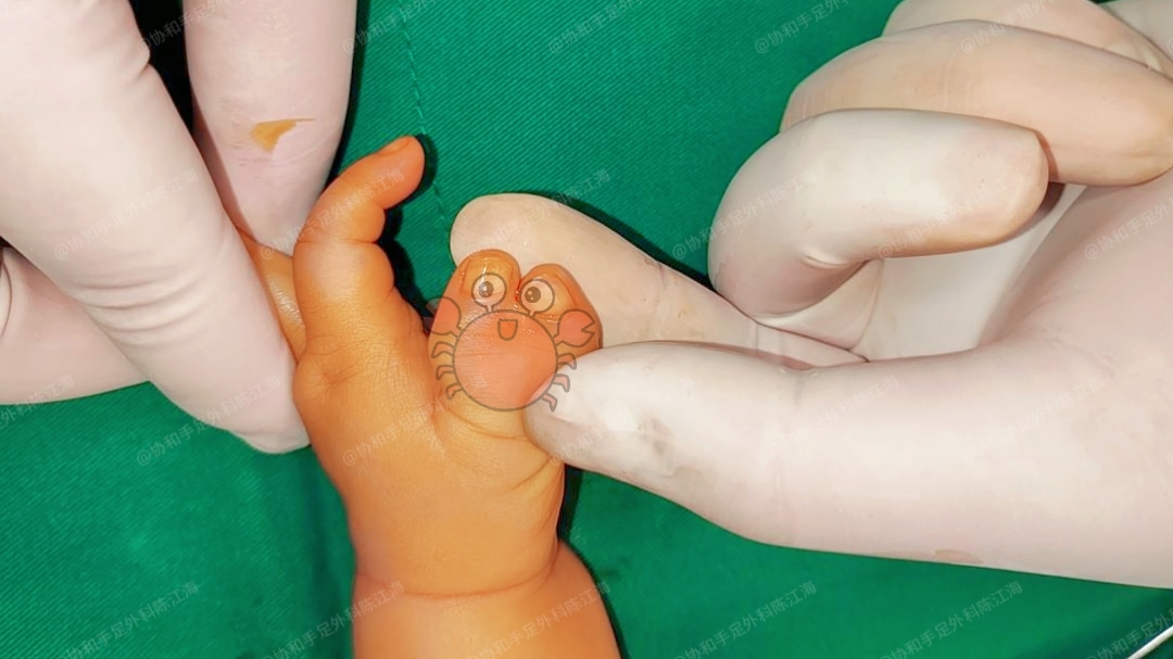 "虽然过程比较艰辛,但如今,值了!"