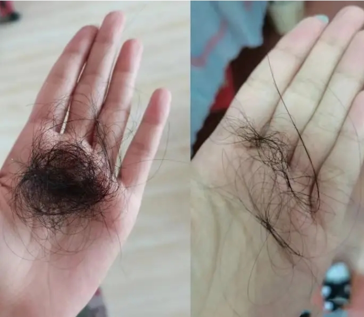 发自内心分享育发经验!头发疯长秘籍!