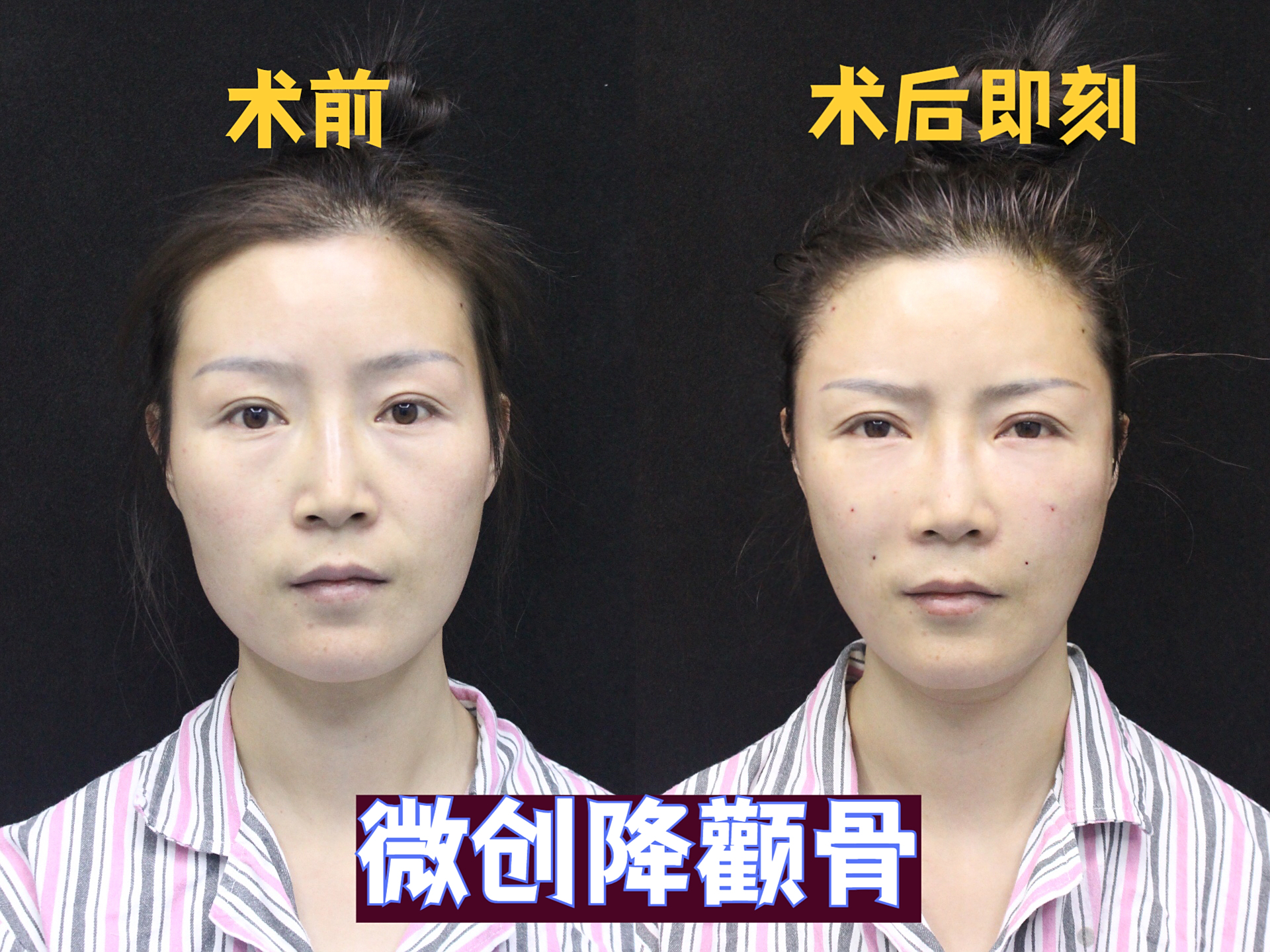 太阳穴凹陷?颧骨凸?