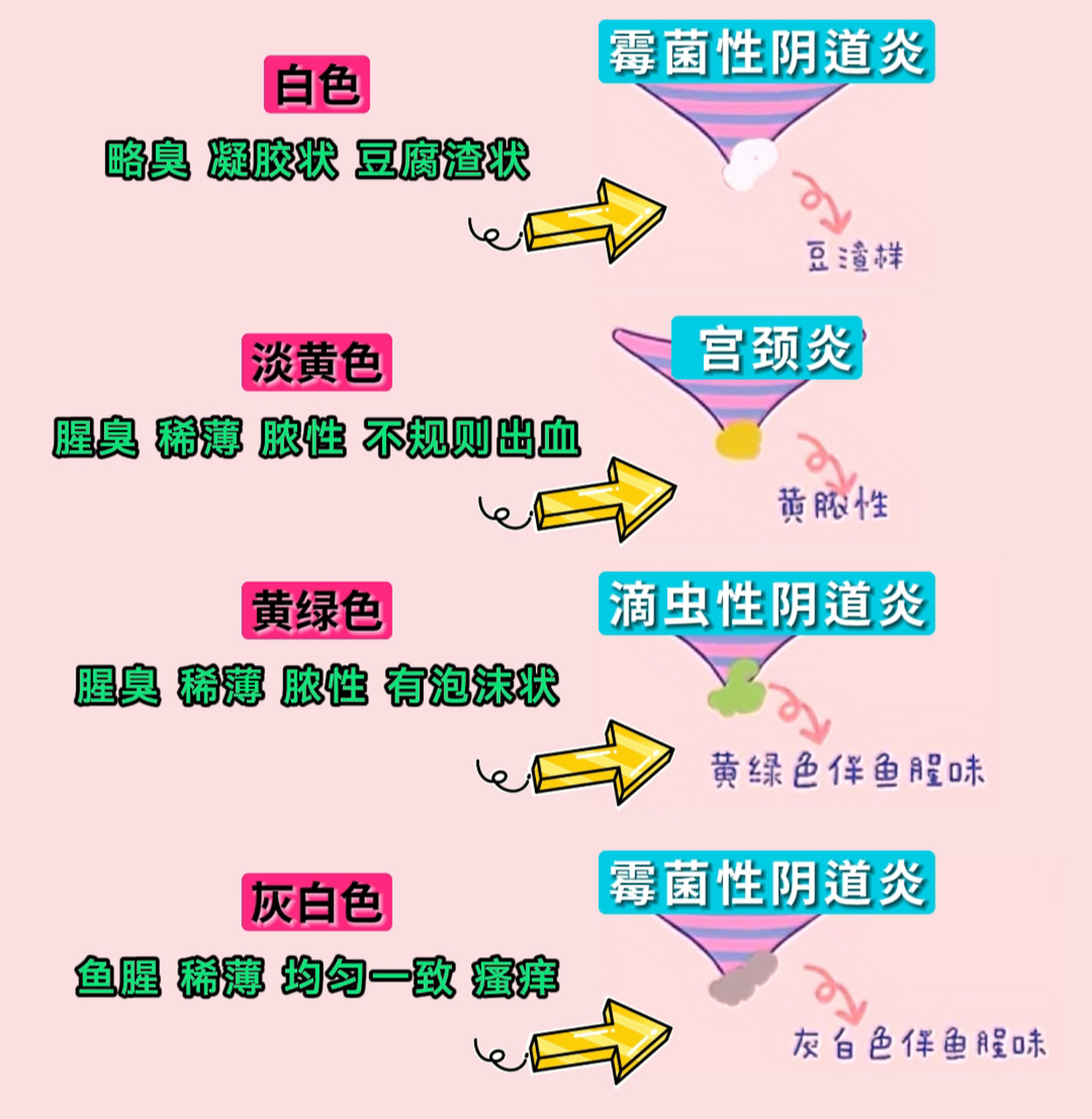 白带的4种异常情况,一张图带你了解!