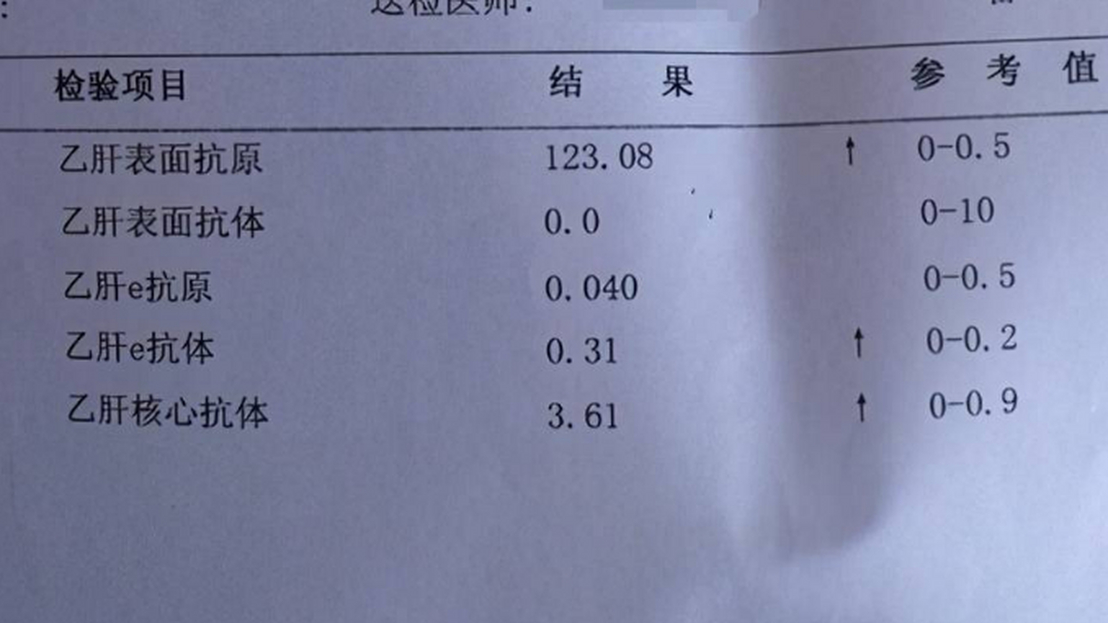 乙肝化验单图片