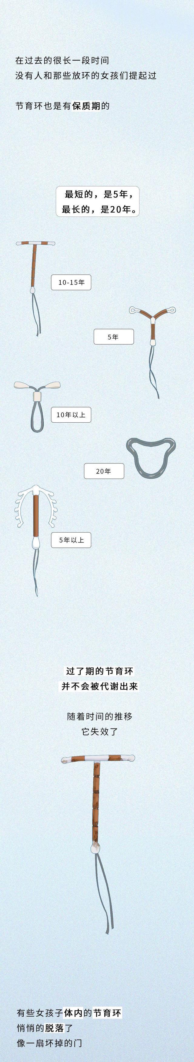 漫画分享:"节育环"在女性体内的20年,据说没人能笑着看完
