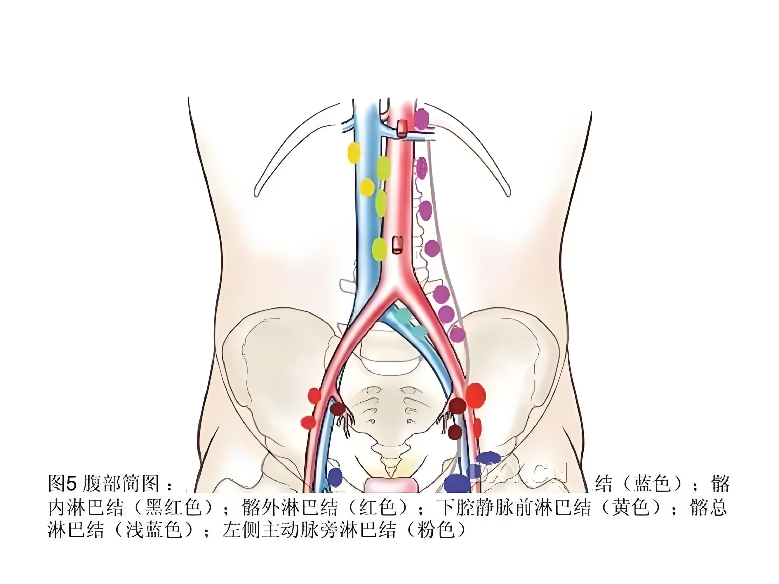 腹腔淋巴结位置图图片