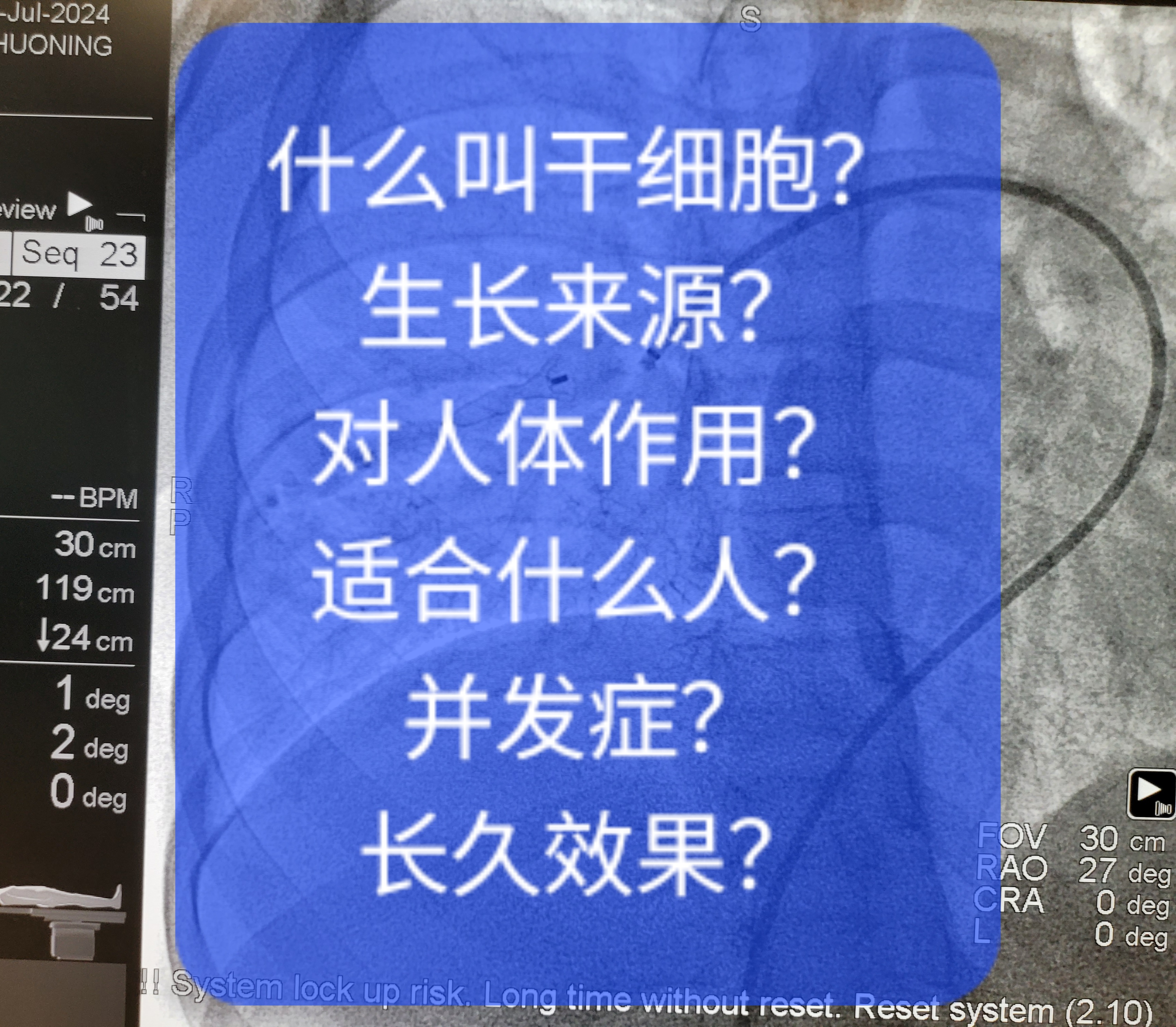 什么叫干细胞?生长来源?对人体作用?适合什么人?并发症?