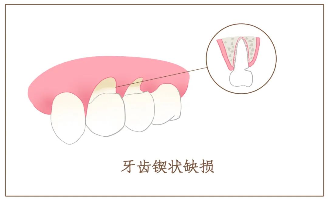 牙齿坏处图片