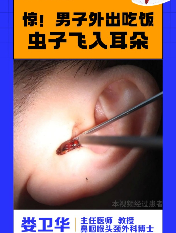 耳朵里进虫子?及时就医取出!