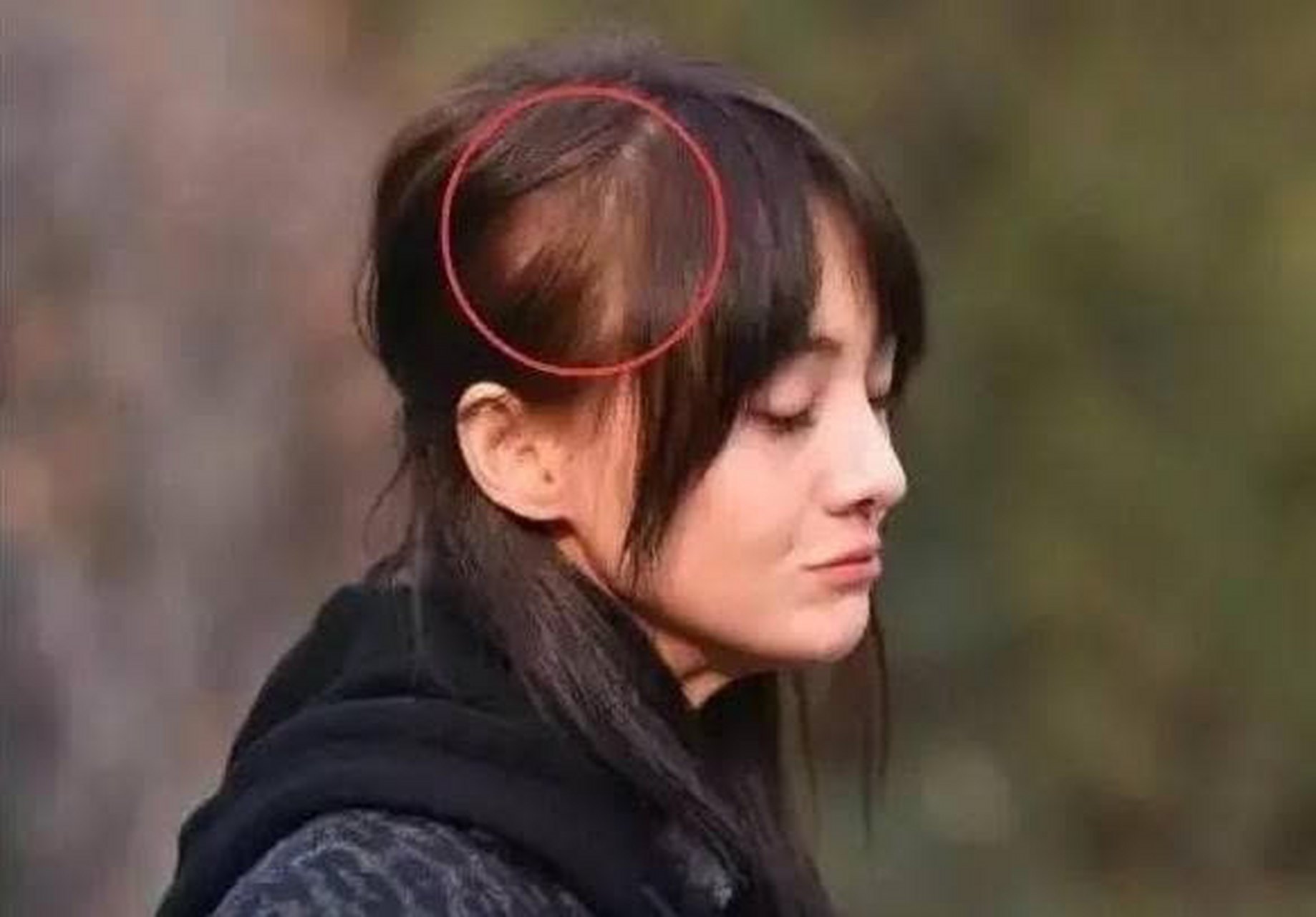 秃头警告
