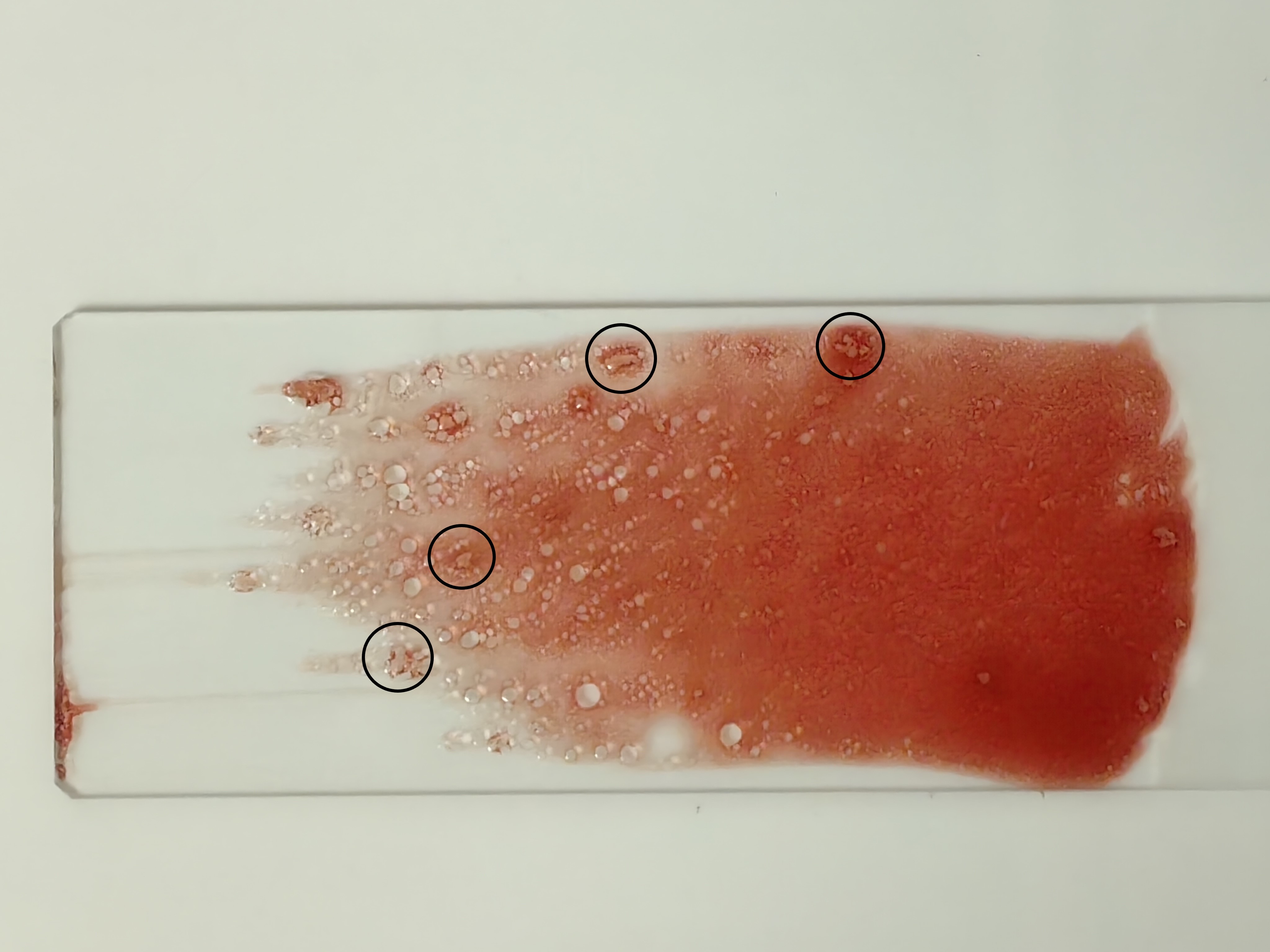 为什么骨髓涂片中会见到"小颗粒"?