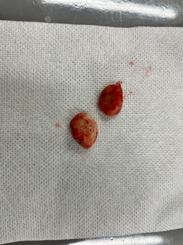 狗狗鸟粪石取出之后不再出现尿血