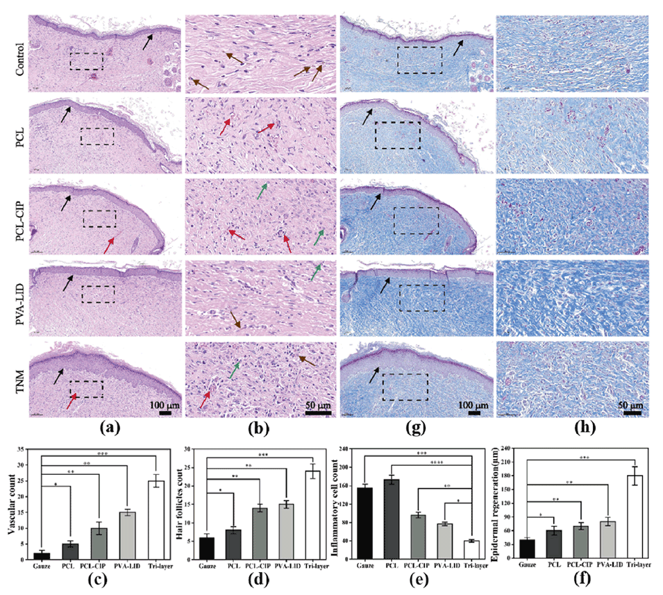 具有非对称润湿性的三层纳米纤维敷料,用于伤口愈合