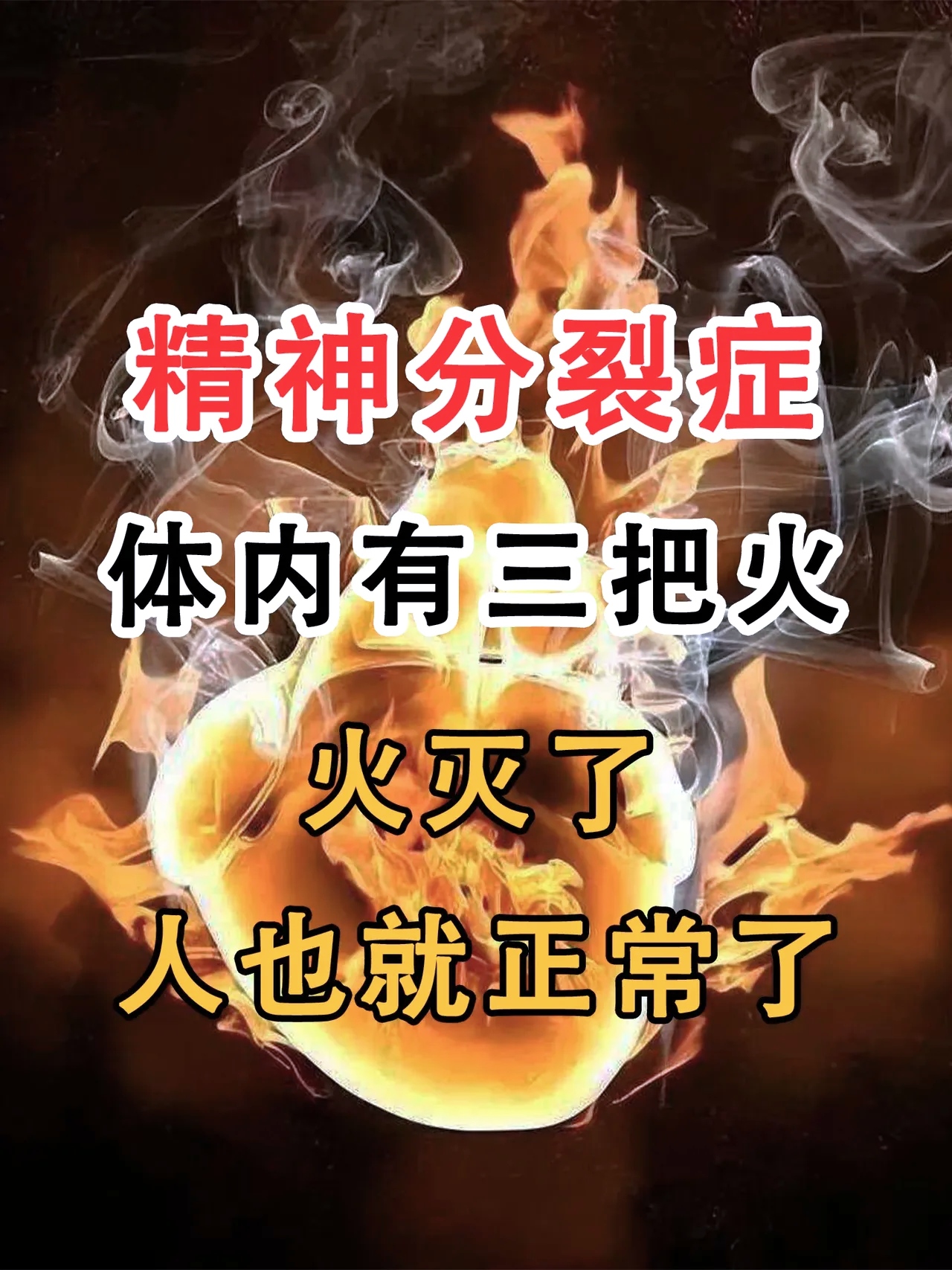 如果火被扑灭,人就会恢复正常 精神分裂症主要是气,血,痰火所致.