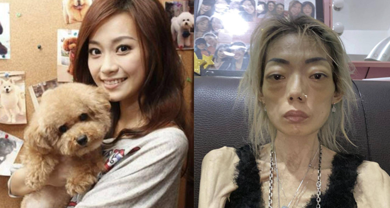 豪门玩物,几年被折磨成牙齿全脱落,不足80斤,半人半鬼惨不忍睹