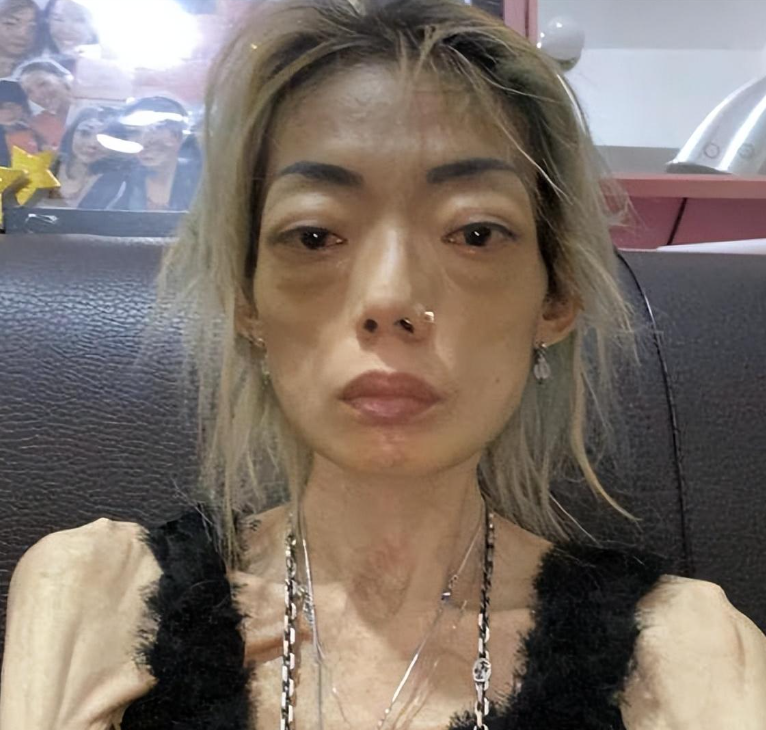 豪门玩物,几年被折磨成牙齿全脱落,不足80斤,半人半鬼惨不忍睹