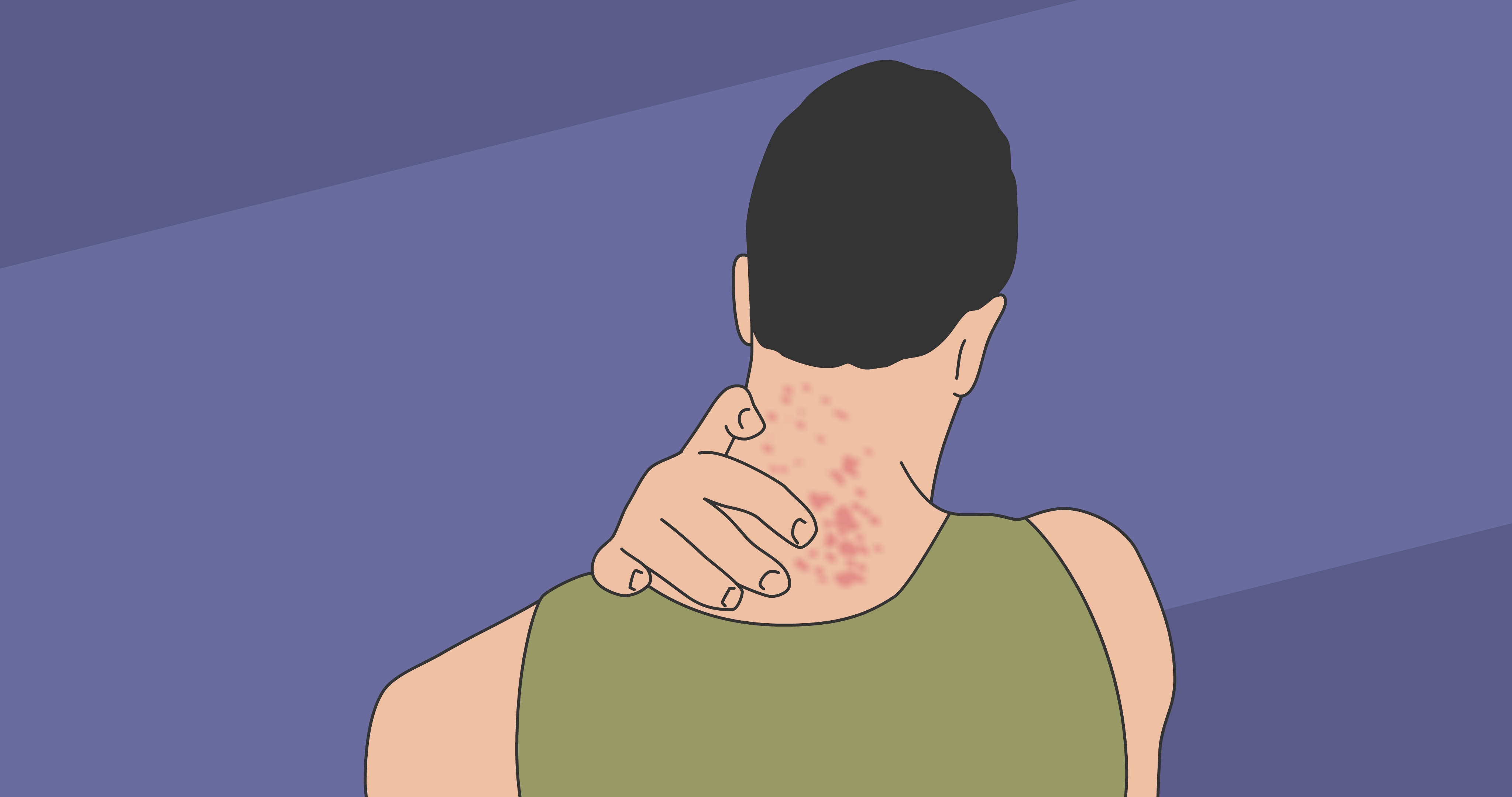 关于带状疱疹,反复发作,有6个真相要提前了解清楚!