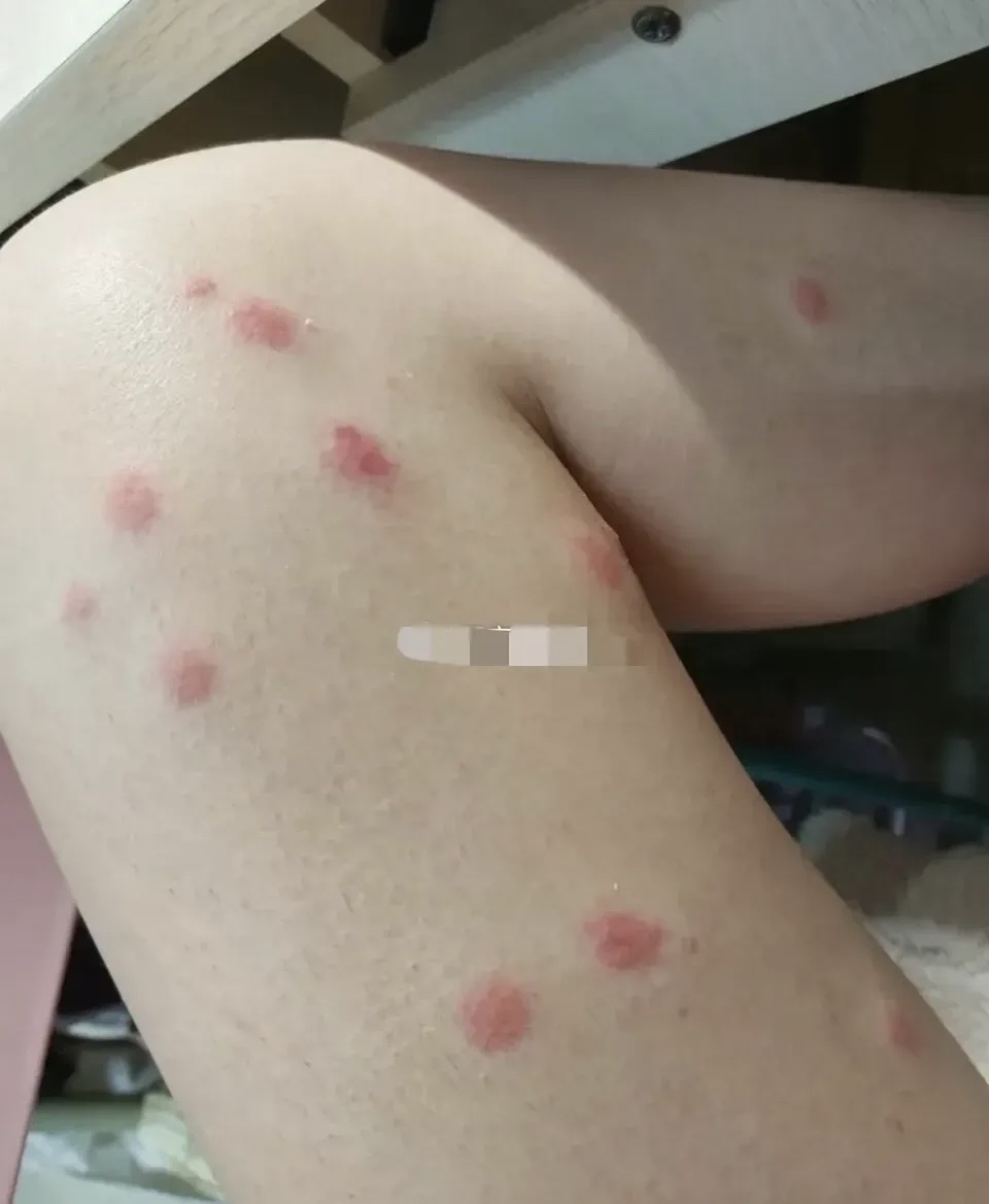 这是什么病啊?是不是对方传过来的呢? 太害怕了.女儿下的每天哭.