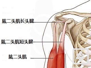 肱二头肌长头腱炎康复图片