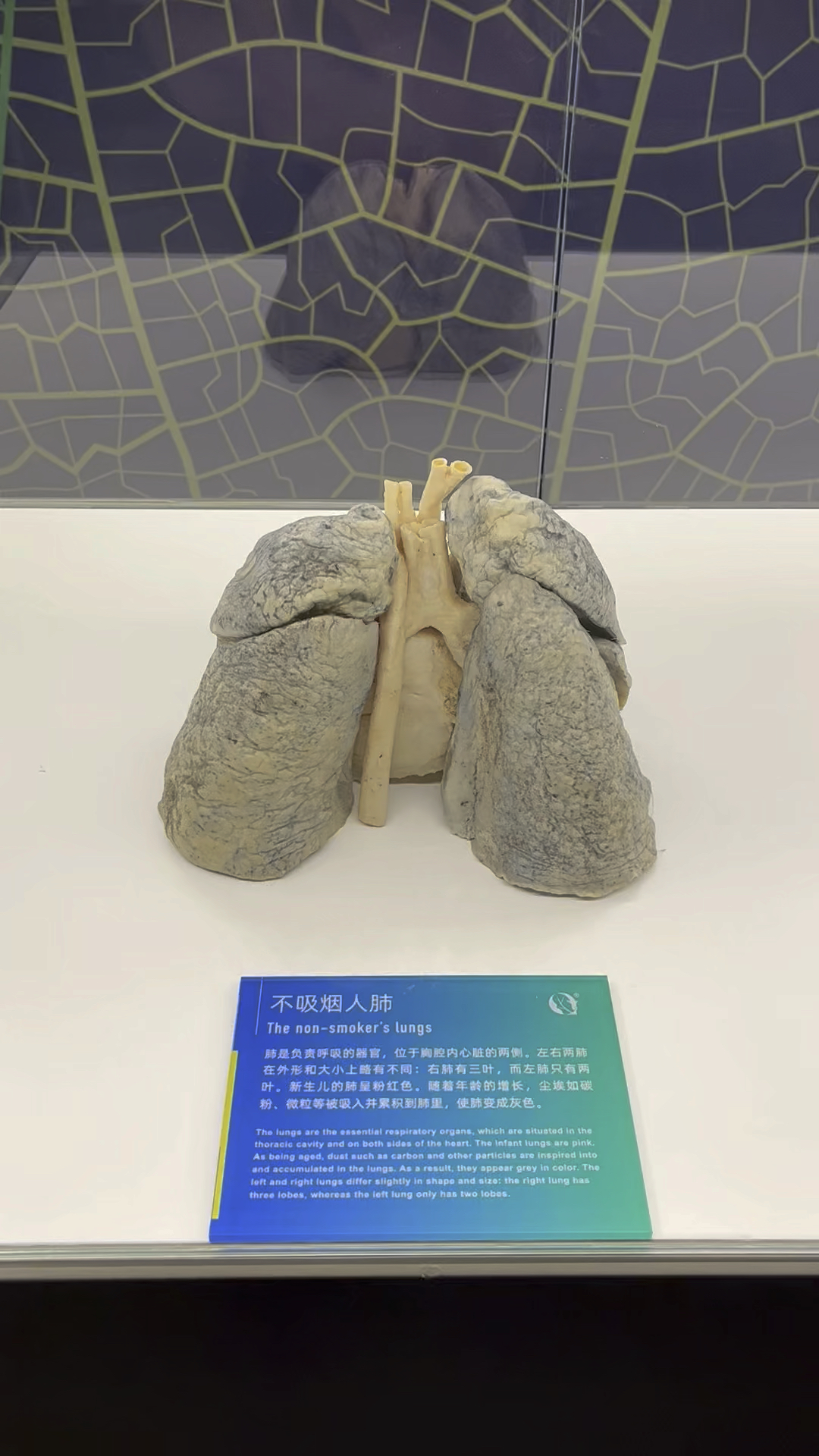 肺标本展示,这可能是我们大多数人的样子