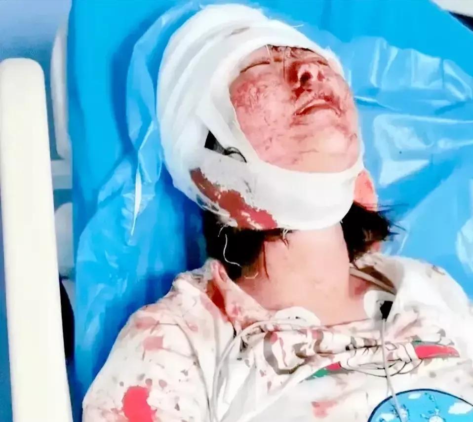 被打的女孩现在怎么样了?她们究竟伤情如何?