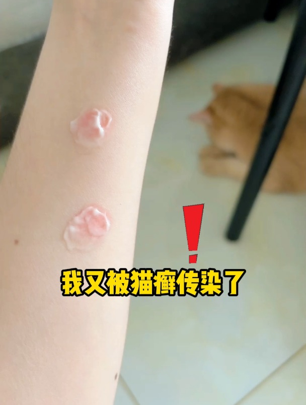 我又被猫癣传染了!家里一只猫长猫癣,其他猫和人也会遭殃