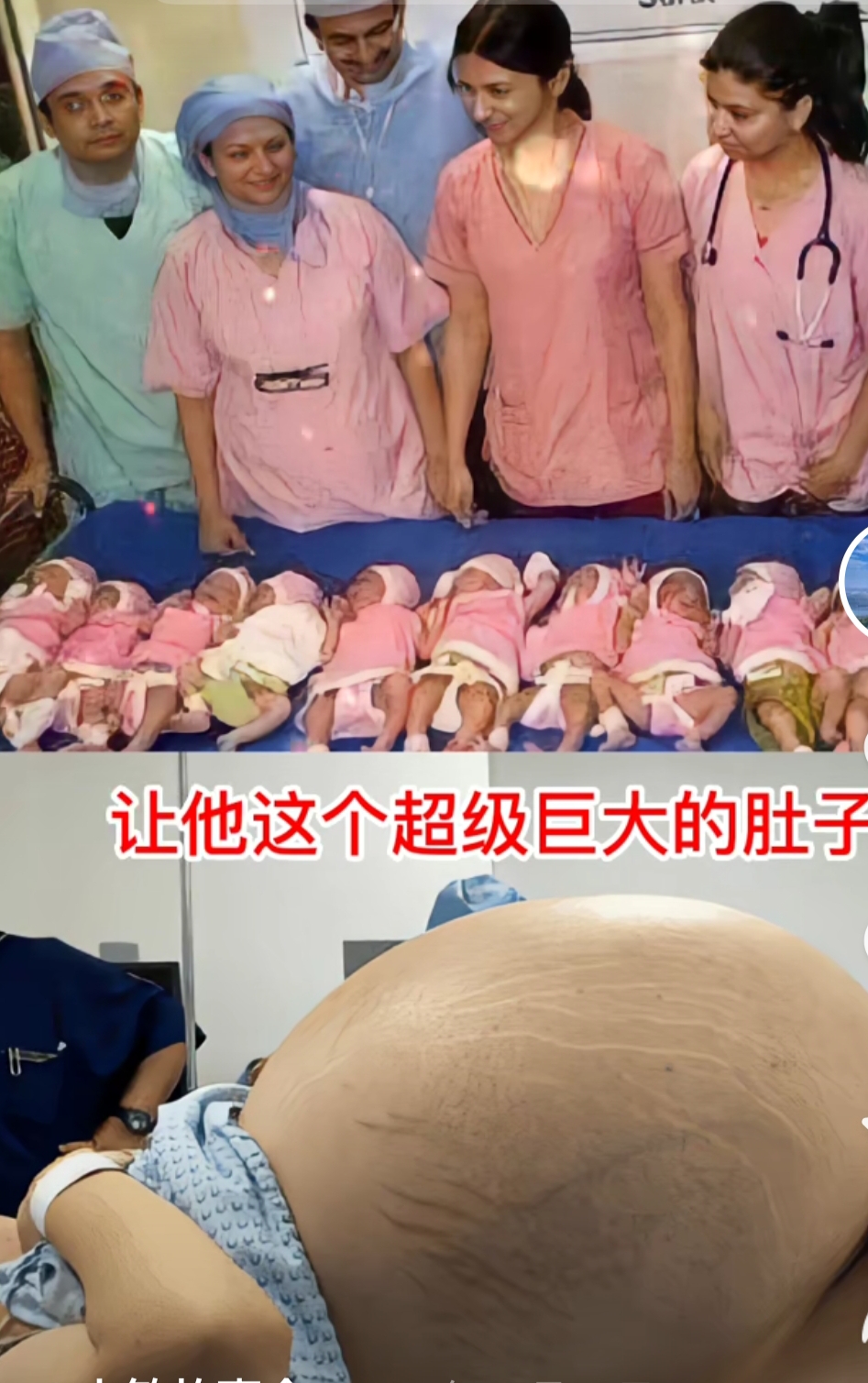 女子怀12胞胎丈夫祈祷一定要生6女6儿,出来之后丈夫直接哭成泪人