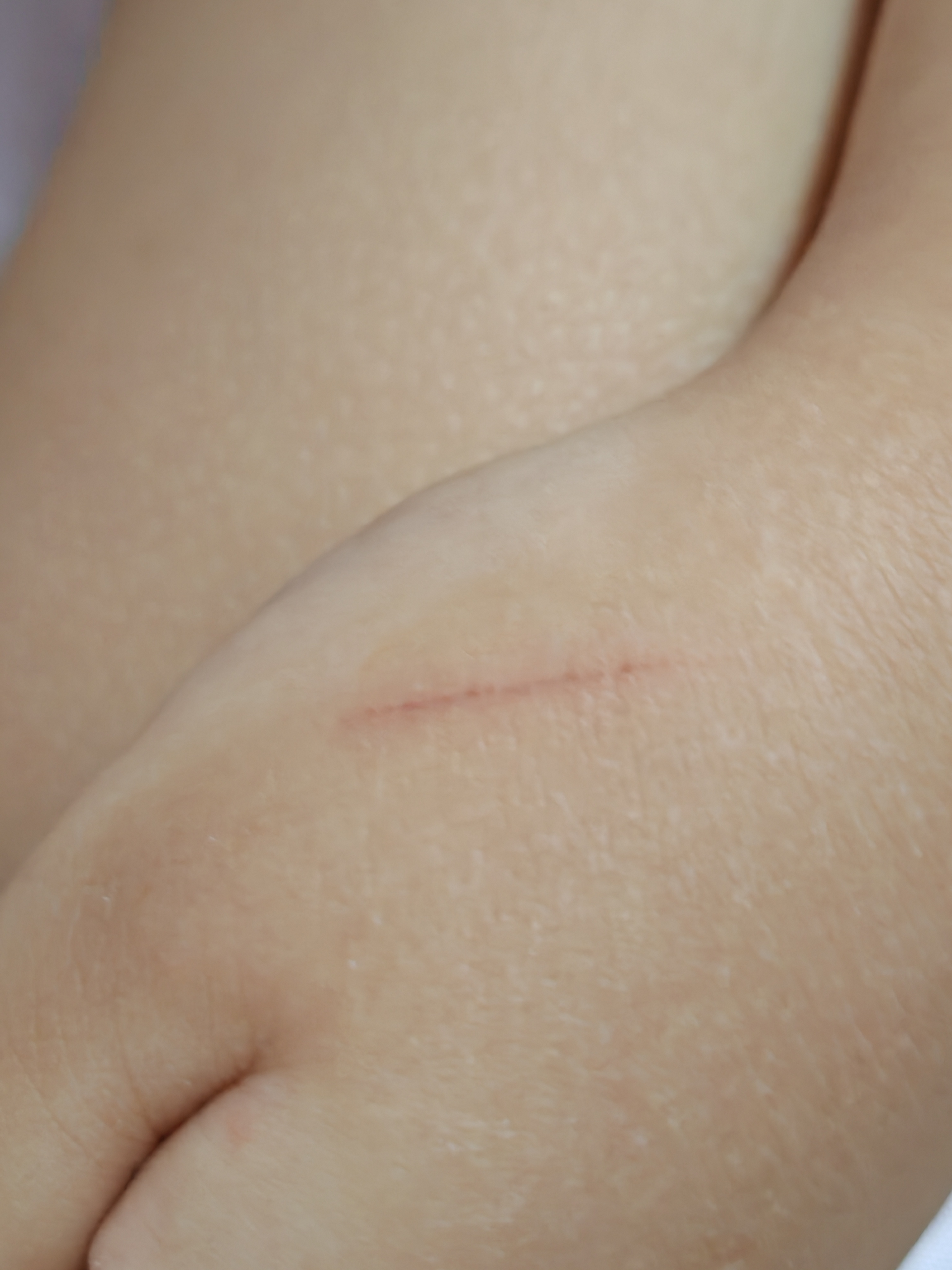 猫咪快五个月了,正常的疫苗接种和定期驱虫,平时在家里没有出去过