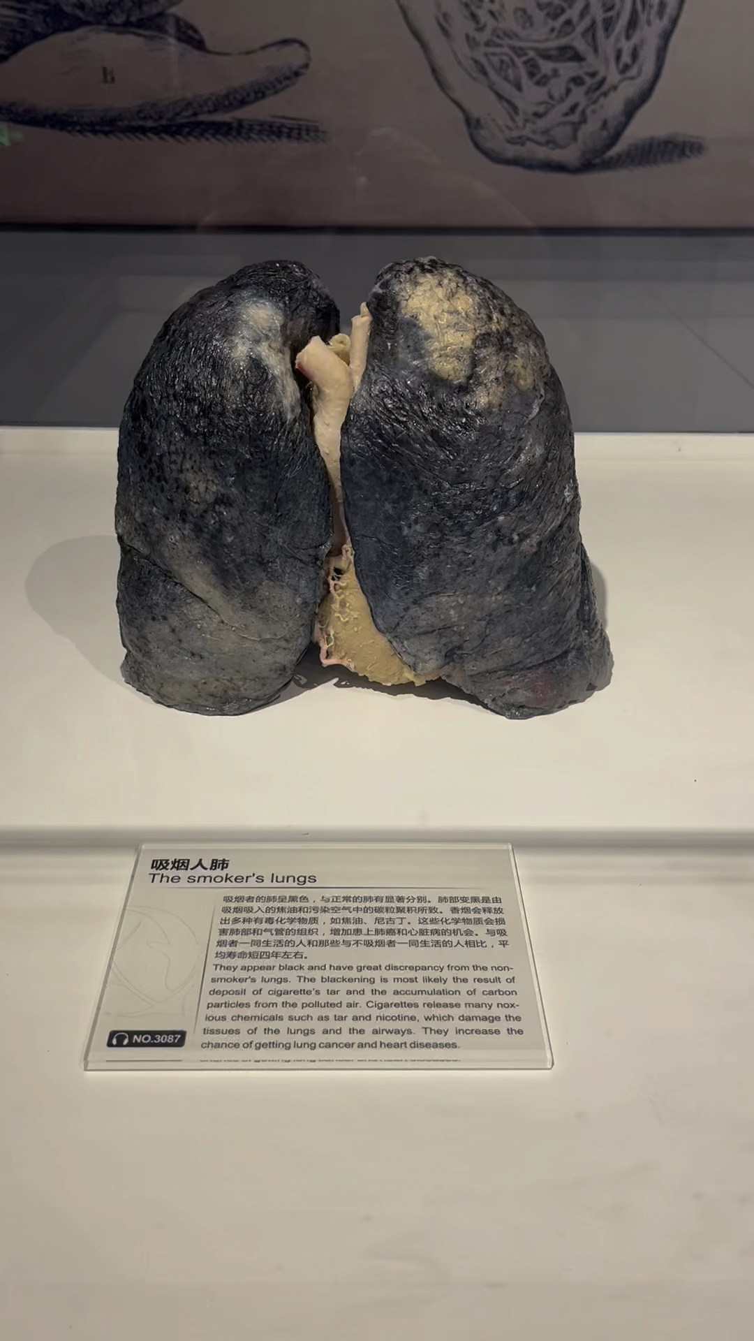 吸烟的肺标本展示,快发给身边吸烟的朋友看看