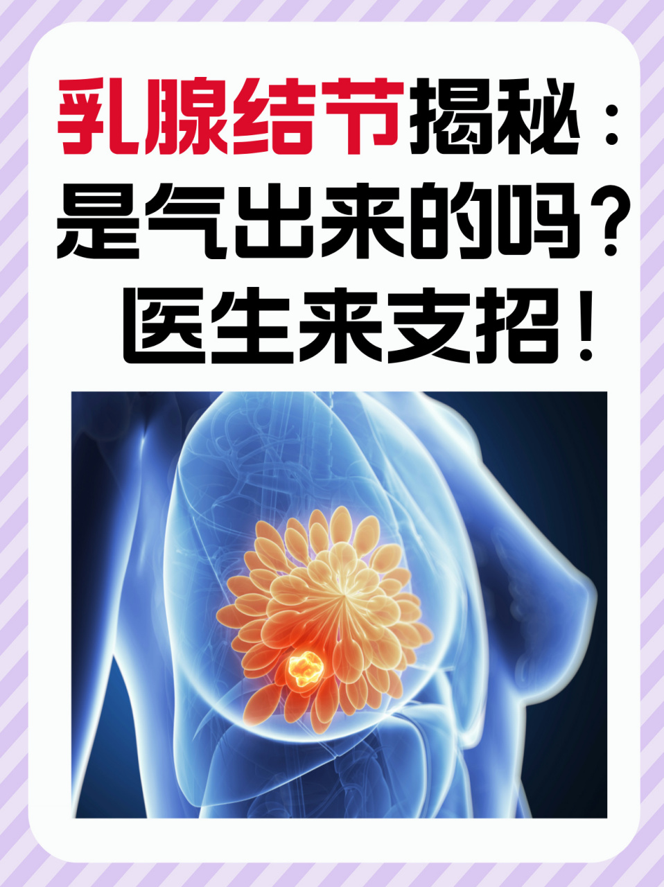 乳腺结节长什么样子图片