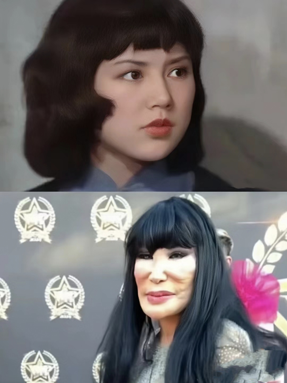 邵音音,中国香港歌手演员,想不到让医美毁了.