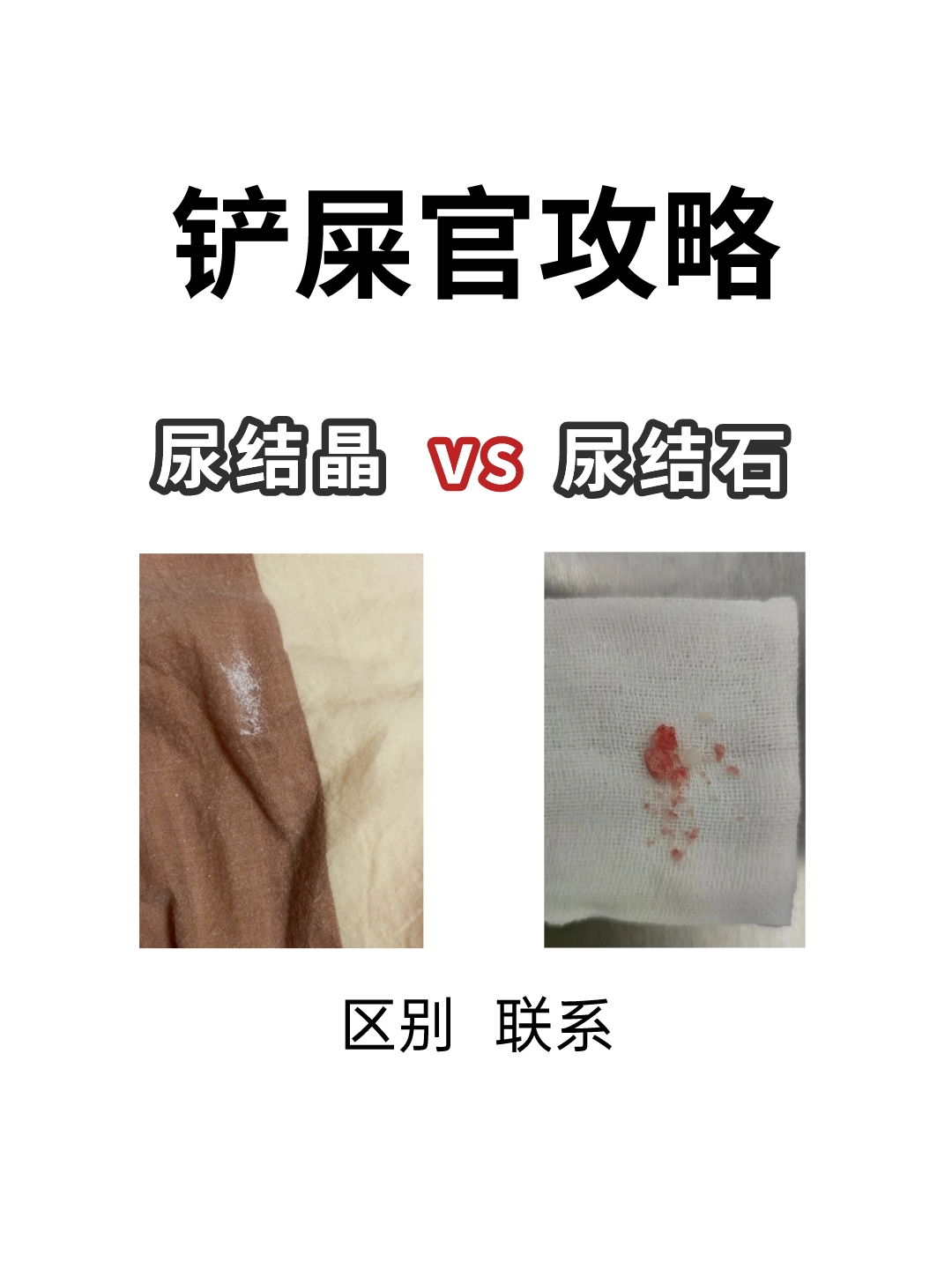 猫咪尿结晶和尿结石的区别