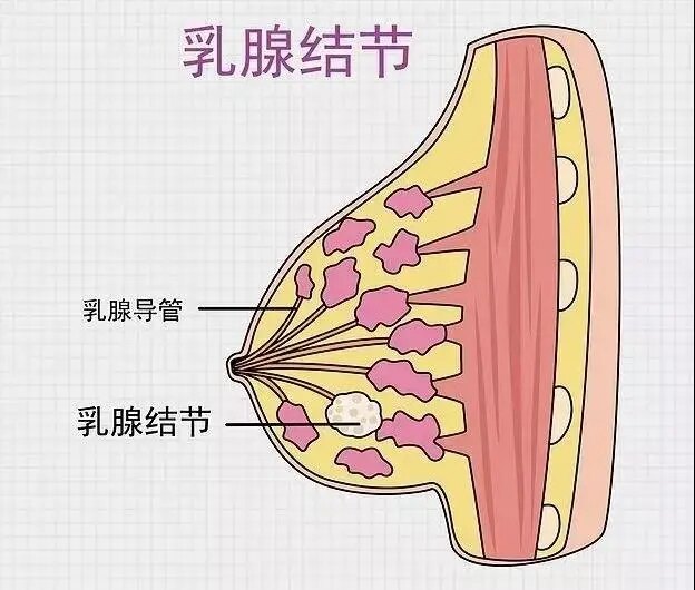 如何护好你的乳房之四 我应用中医药防治良性乳腺病的认识