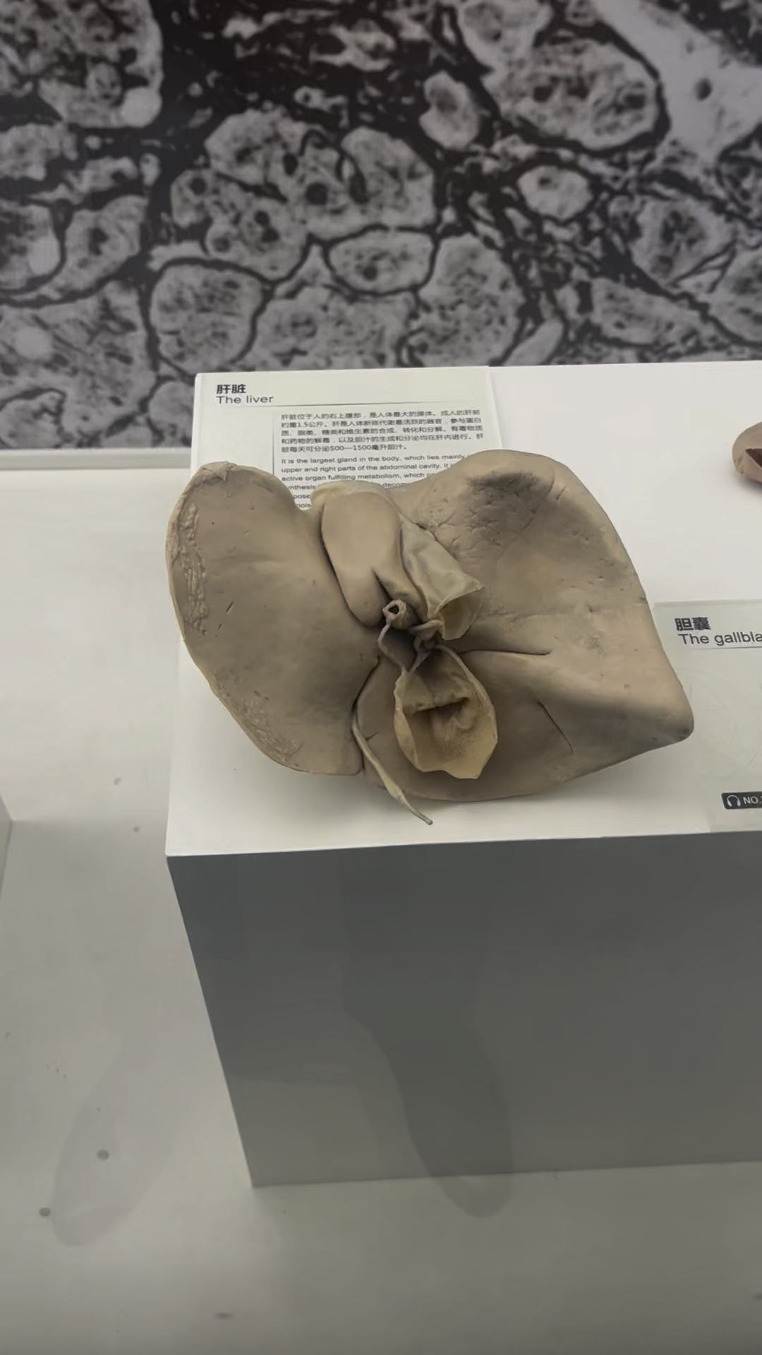 肝脏标本展示和科普,对比看看它们有什么不同