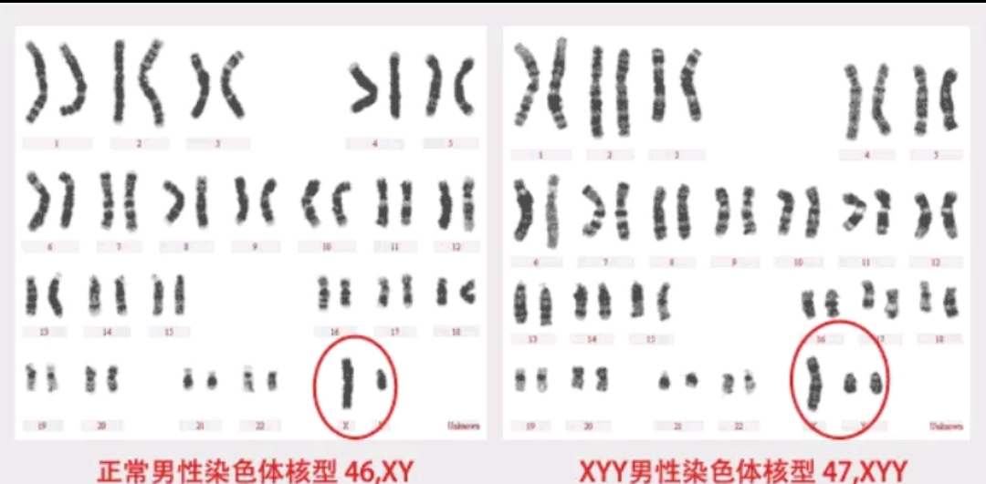 四川双胞胎排名第几(四川双胞胎排名第几名)