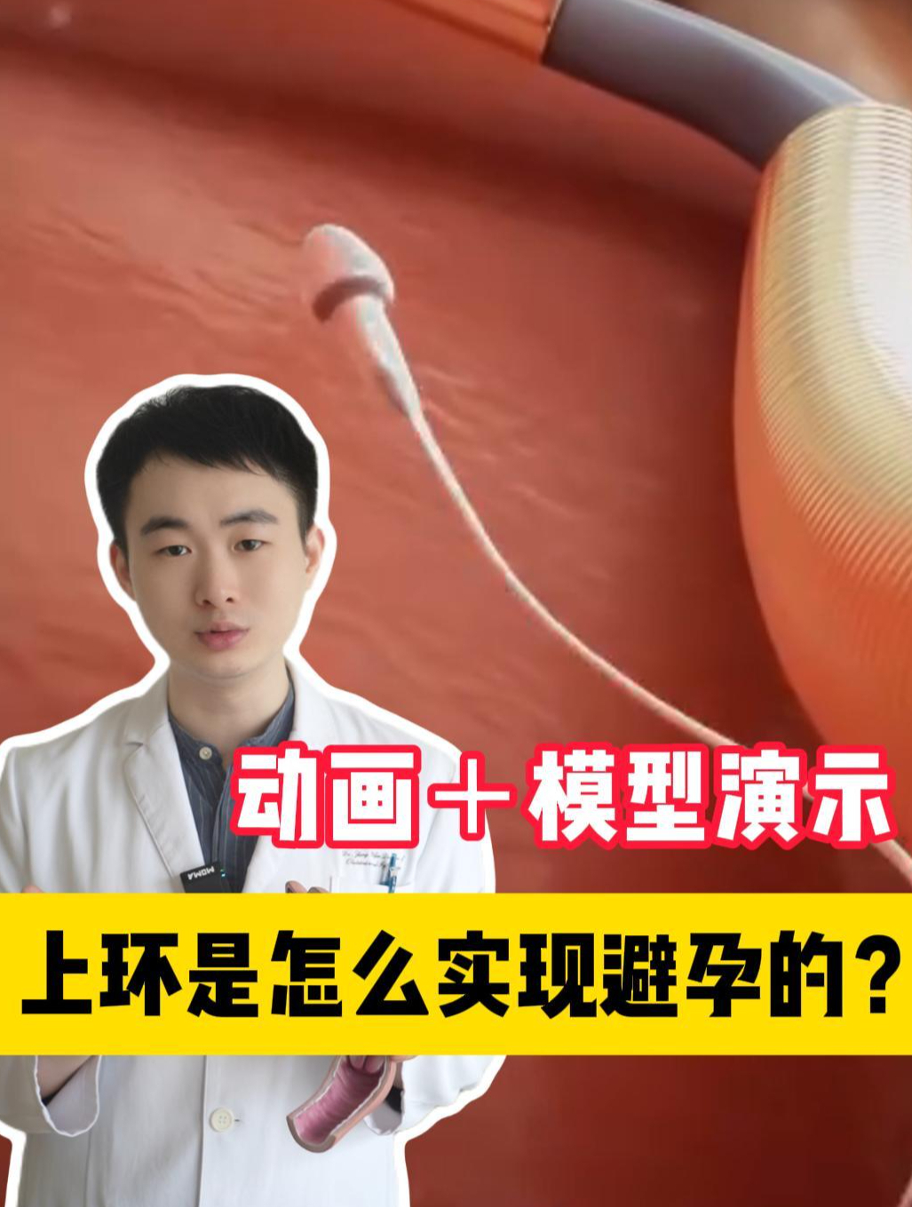 上了环为啥就不会怀孕了?节育环的避孕原理是什么?